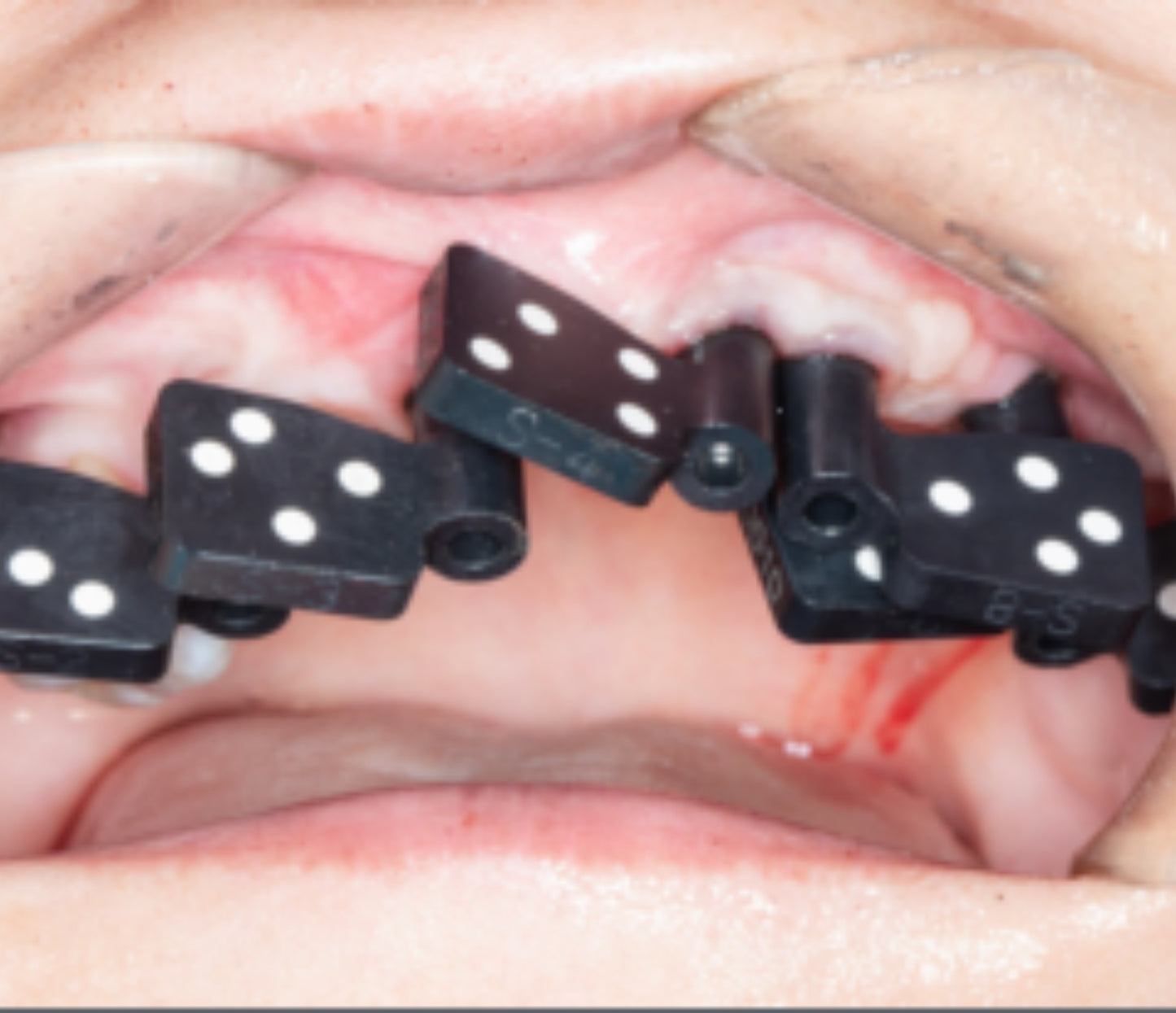 PALM Dental Photogrammetry Scanner