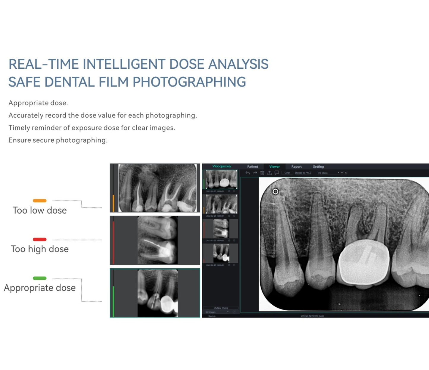 Sistem fosfornih ploča za ultravisoku rezoluciju digitalnih rendgen snimaka