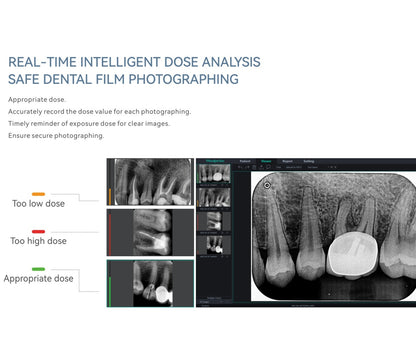 Sistem fosfornih ploča za ultravisoku rezoluciju digitalnih rendgen snimaka